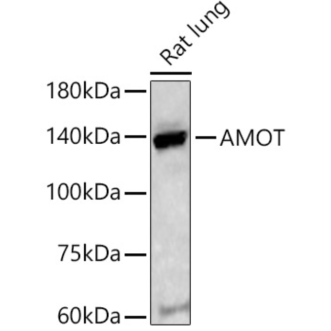 AMOT Rabbit Polyclonal Antibody