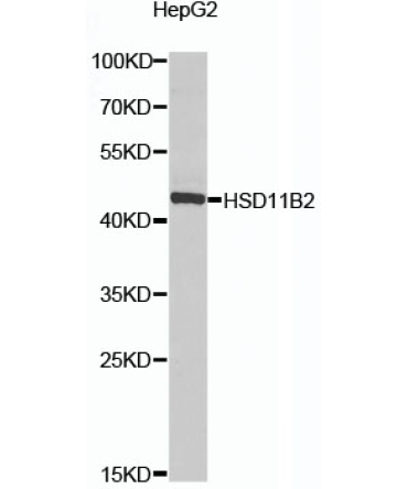 HSD11B2 Rabbit Polyclonal Antibody