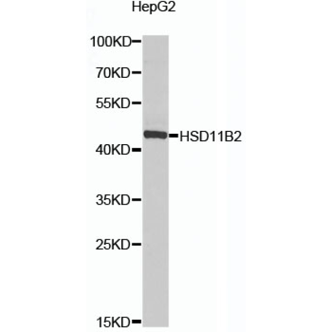 HSD11B2 Rabbit Polyclonal Antibody
