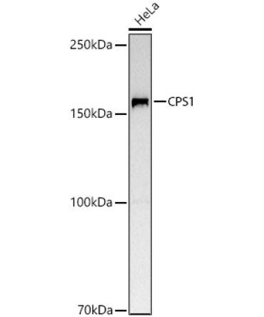 CPS1 Rabbit Polyclonal Antibody
