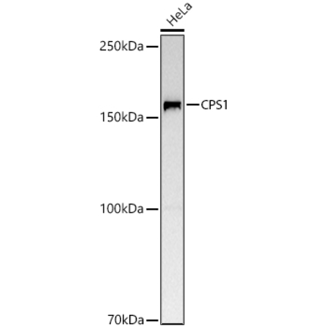 CPS1 Rabbit Polyclonal Antibody