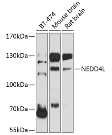 NEDD4L Rabbit Polyclonal Antibody