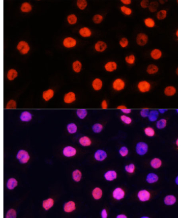MonoMethyl-NONO/p54nrb-R357/R365 Rabbit Polyclonal Antibody