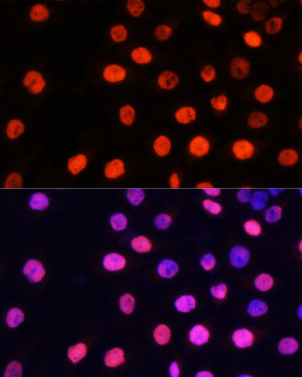 MonoMethyl-NONO/p54nrb-R357/R365 Rabbit Polyclonal Antibody