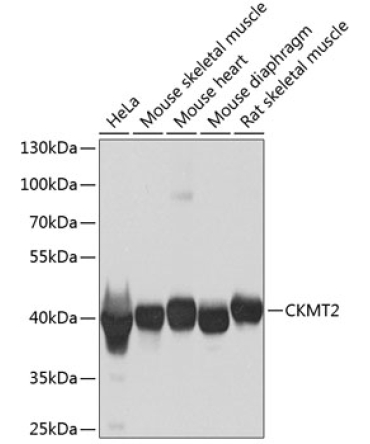 CKMT2 Rabbit Polyclonal Antibody