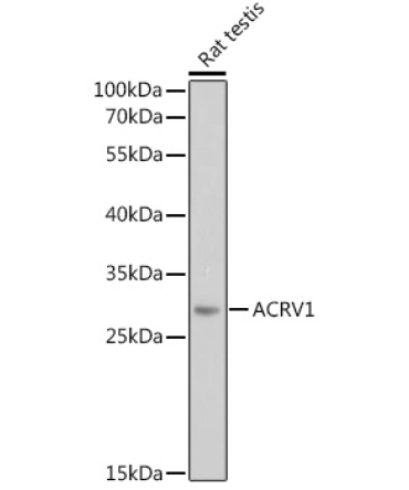 ACRV1 Rabbit Polyclonal Antibody