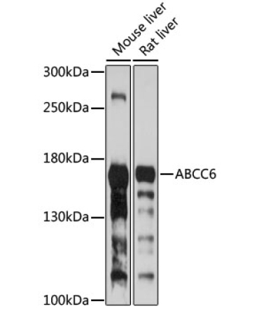 ABCC6 Rabbit Polyclonal Antibody