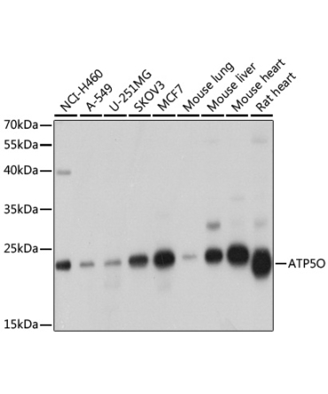 ATP5O Rabbit Polyclonal Antibody