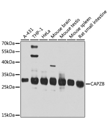 CAPZB Rabbit Polyclonal Antibody