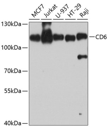 CD6 Rabbit Polyclonal Antibody