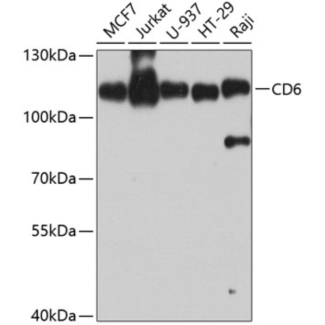 CD6 Rabbit Polyclonal Antibody