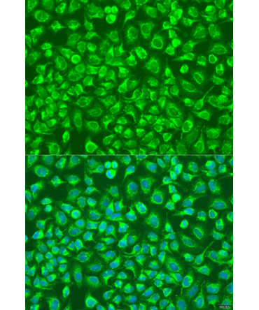 ENTPD5 Rabbit Polyclonal Antibody