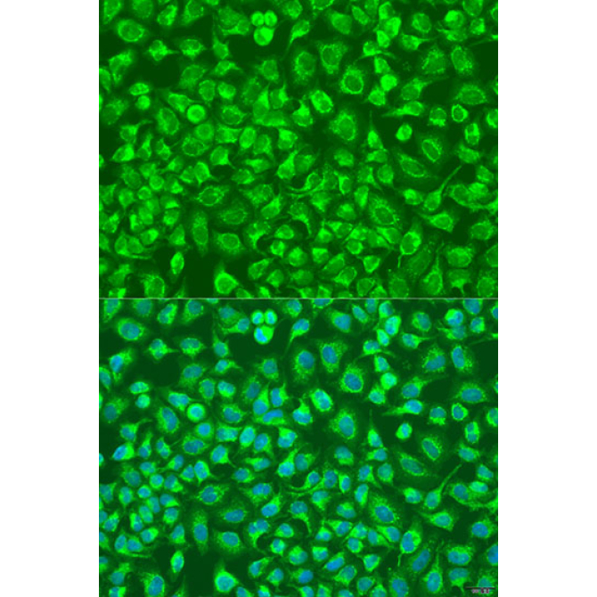 ENTPD5 Rabbit Polyclonal Antibody