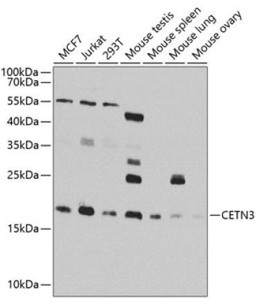 CETN3 Rabbit Polyclonal Antibody