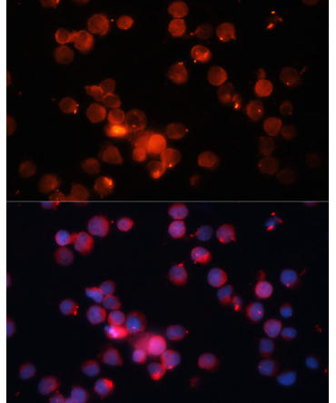 CD66b/CEACAM8 Rabbit Polyclonal Antibody