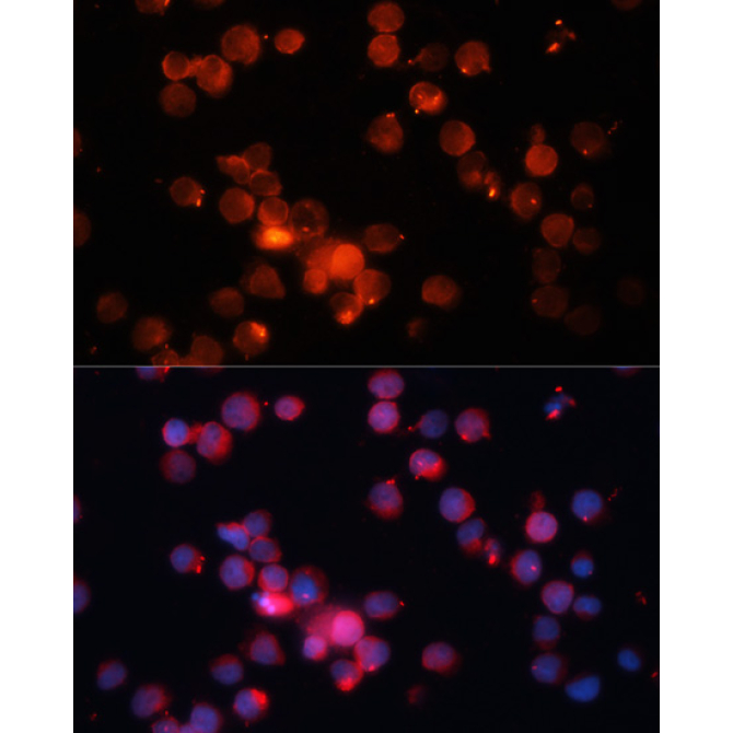 CD66b/CEACAM8 Rabbit Polyclonal Antibody