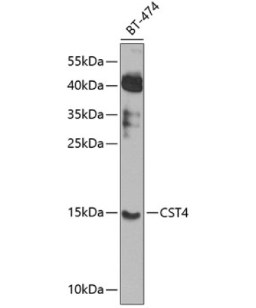 CST4 Rabbit Polyclonal Antibody