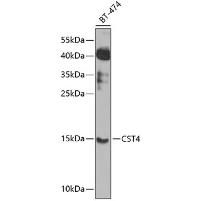 CST4 Rabbit Polyclonal Antibody