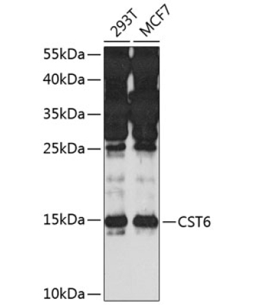 CST6 Rabbit Polyclonal Antibody