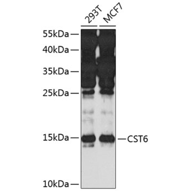 CST6 Rabbit Polyclonal Antibody