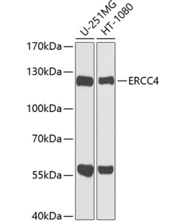 ERCC4 Rabbit Polyclonal Antibody