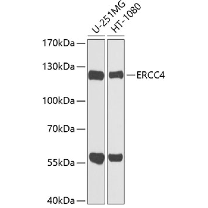 ERCC4 Rabbit Polyclonal Antibody