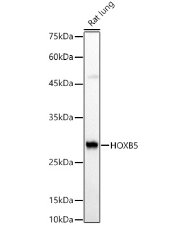 HOXB5 Rabbit Polyclonal Antibody