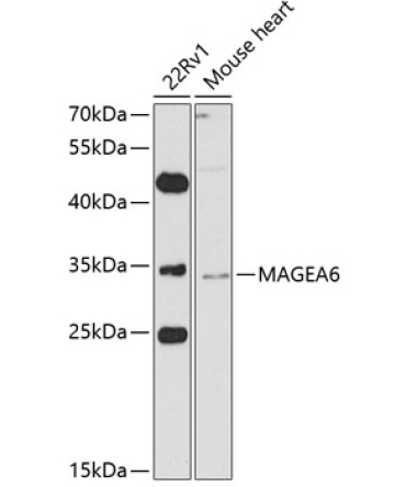 MAGEA6 Rabbit Polyclonal Antibody
