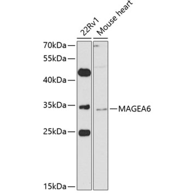 MAGEA6 Rabbit Polyclonal Antibody