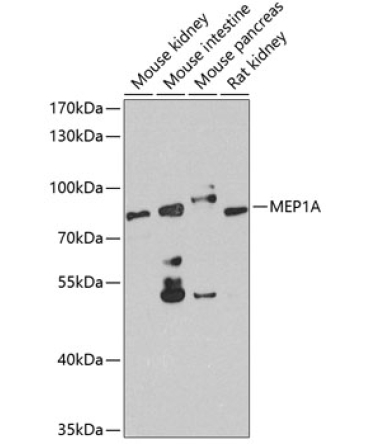 MEP1A Rabbit Polyclonal Antibody