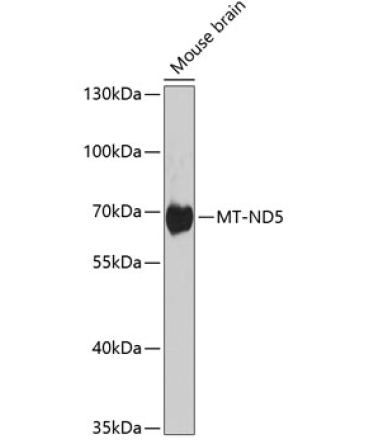 MT-ND5 Rabbit Polyclonal Antibody