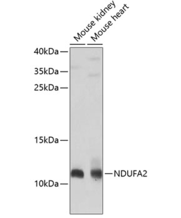 NDUFA2 Rabbit Polyclonal Antibody