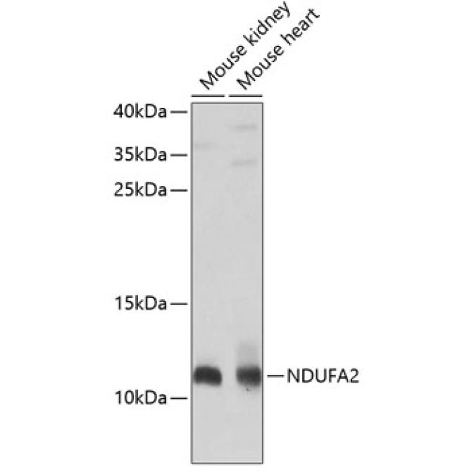 NDUFA2 Rabbit Polyclonal Antibody