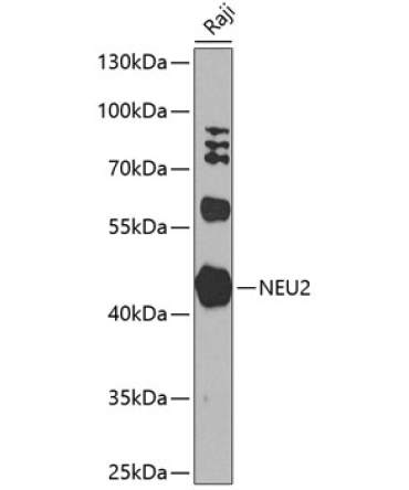 NEU2 Rabbit Polyclonal Antibody