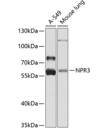 NPR3 Rabbit Polyclonal Antibody