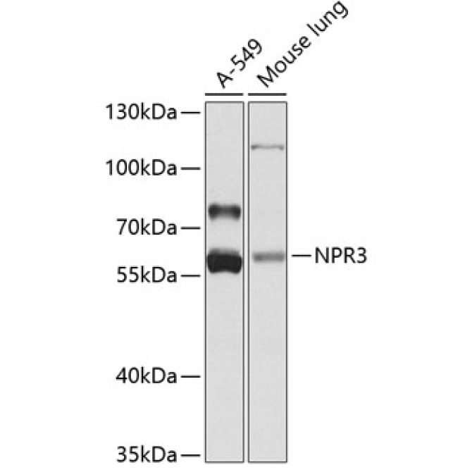 NPR3 Rabbit Polyclonal Antibody