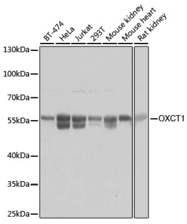 OXCT1 Rabbit Polyclonal Antibody