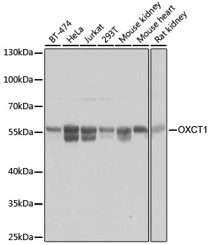 OXCT1 Rabbit Polyclonal Antibody