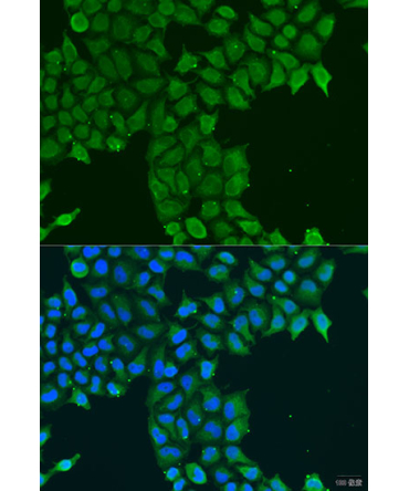 CDK16 Rabbit Polyclonal Antibody