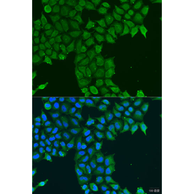 CDK16 Rabbit Polyclonal Antibody