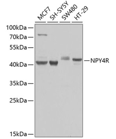 NPY4R Rabbit Polyclonal Antibody