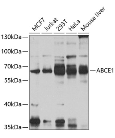 ABCE1 Rabbit Polyclonal Antibody