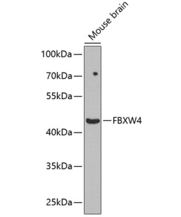 FBXW4 Rabbit Polyclonal Antibody