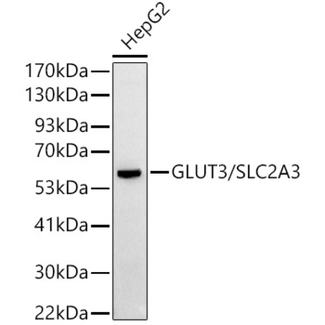 GLUT3/SLC2A3 Rabbit Polyclonal Antibody