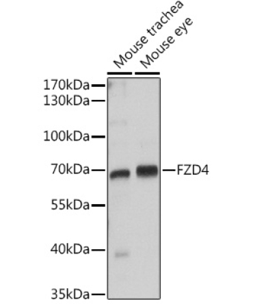 FZD4 Rabbit Polyclonal Antibody