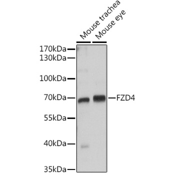 FZD4 Rabbit Polyclonal Antibody