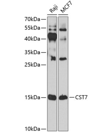 CST7 Rabbit Polyclonal Antibody