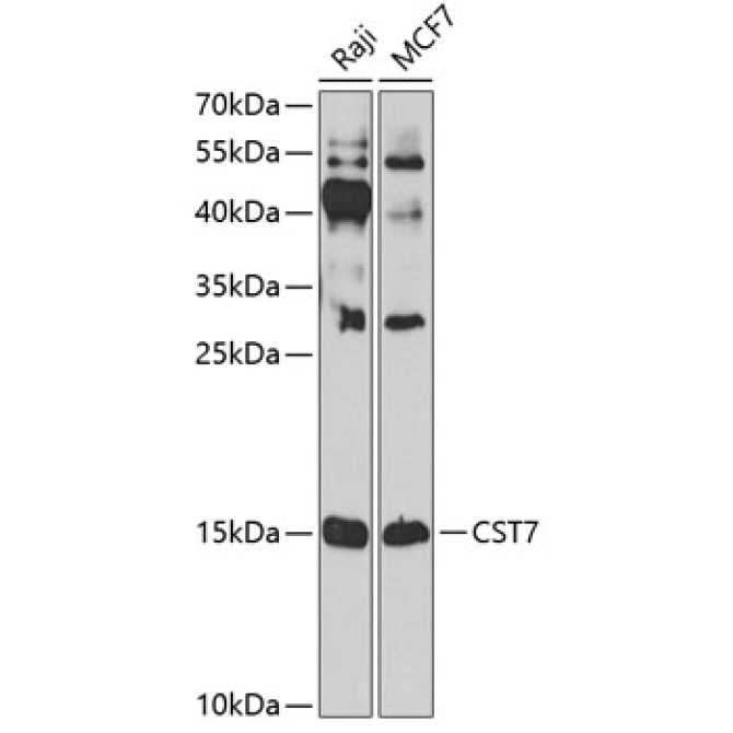 CST7 Rabbit Polyclonal Antibody
