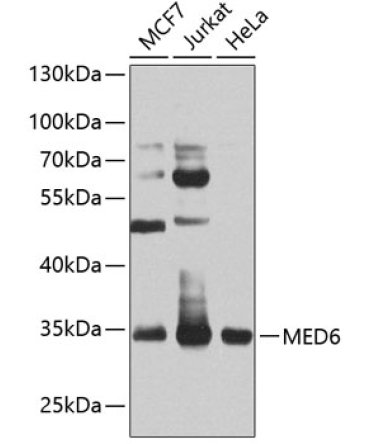 MED6 Rabbit Polyclonal Antibody