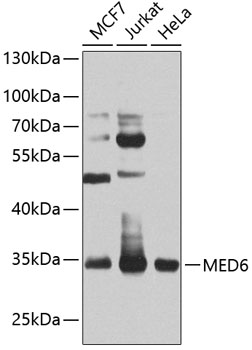 MED6 Rabbit Polyclonal Antibody